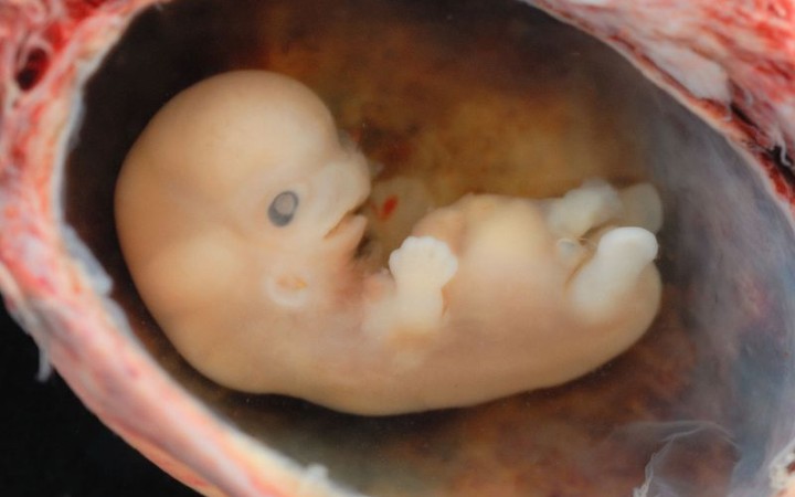 V laboratóriu vytvorili syntetické ľudské embryá. Čo to pre nás znamená?