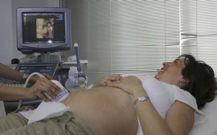 Profesori práva i medicíny sa postavili proti. „Nerešpektujete najnovšie poznatky prenatálnej medicíny!“