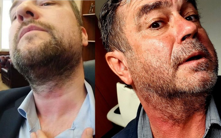 Blaha a Pročko sa dostali v parlamente do konfliktu
