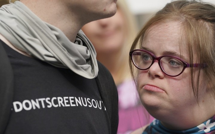 Žena s Downovým syndrómom prehrala v Británii súd o interrupčný zákon